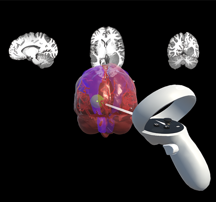 Audiovisual Interactions